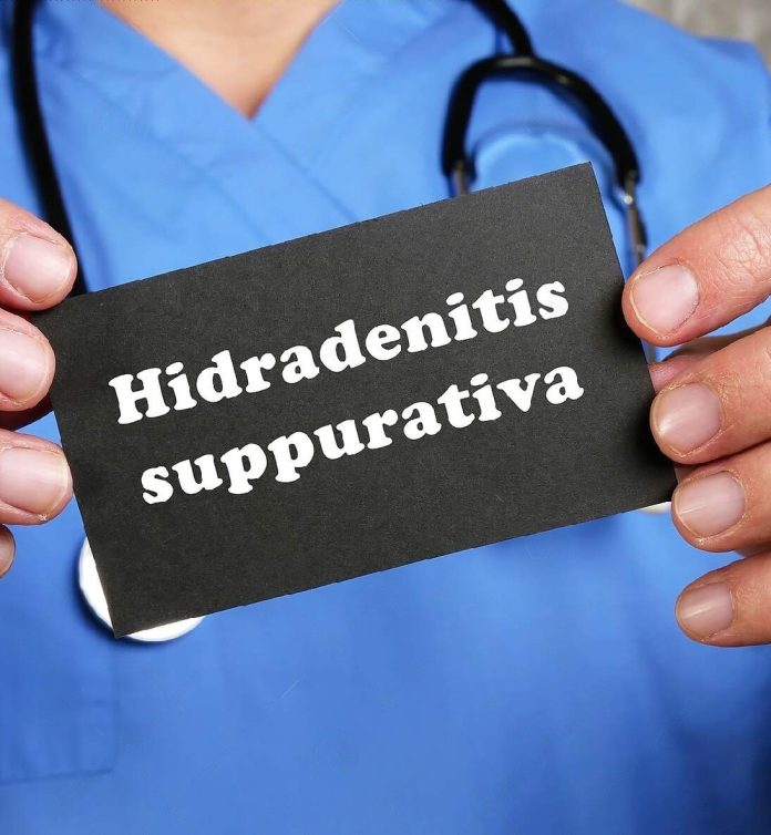 Hidradenitis Suppurativa